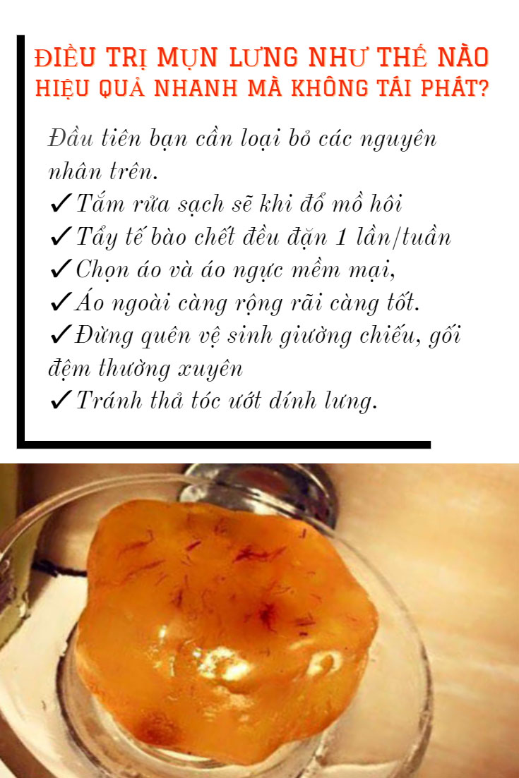 Xà Phòng Trị Mụn Lưng Hổ Phách Baltic Amber