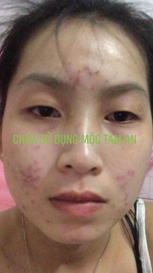 Mộc tâm an 2019
